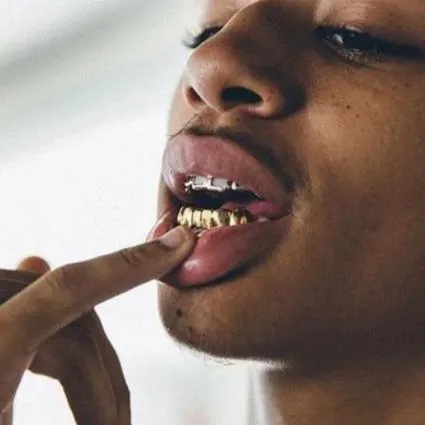 18K Gold Plated Grillz Set